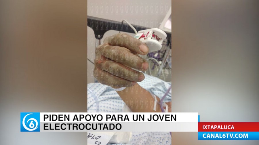 Madre de joven que se electrocutó solicita ayuda