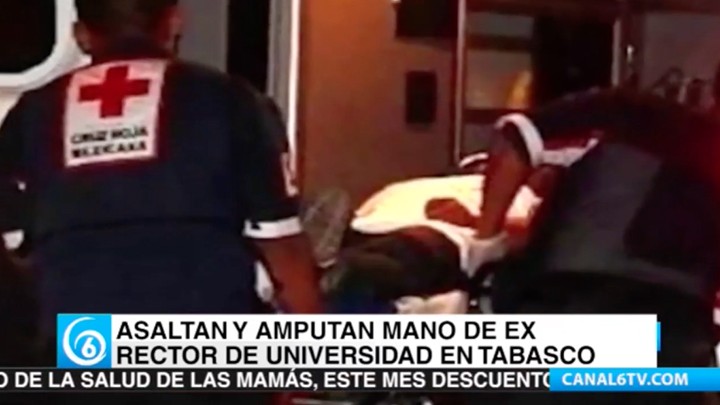 Asaltan y amputan mano del ex rector de la Universidad de Tabasco