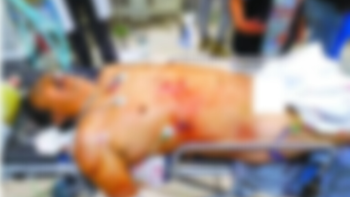 Balean y acuchillan a jóvenes en Chalco