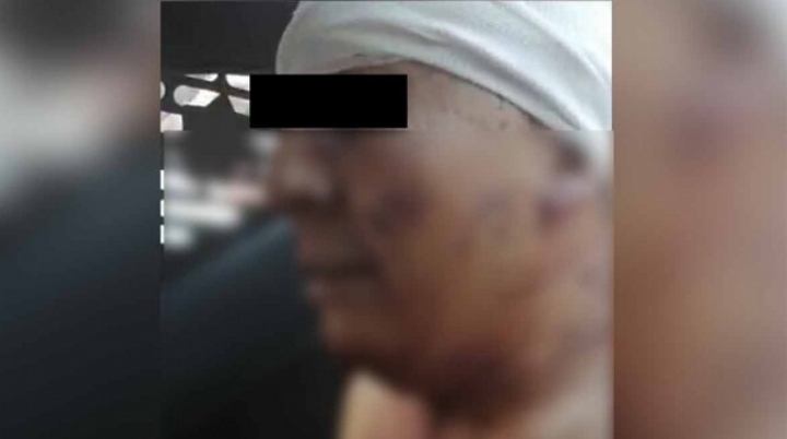 Sujeto mata a su esposa a puñaladas después la desolló y le quitó las vísceras en la GAM