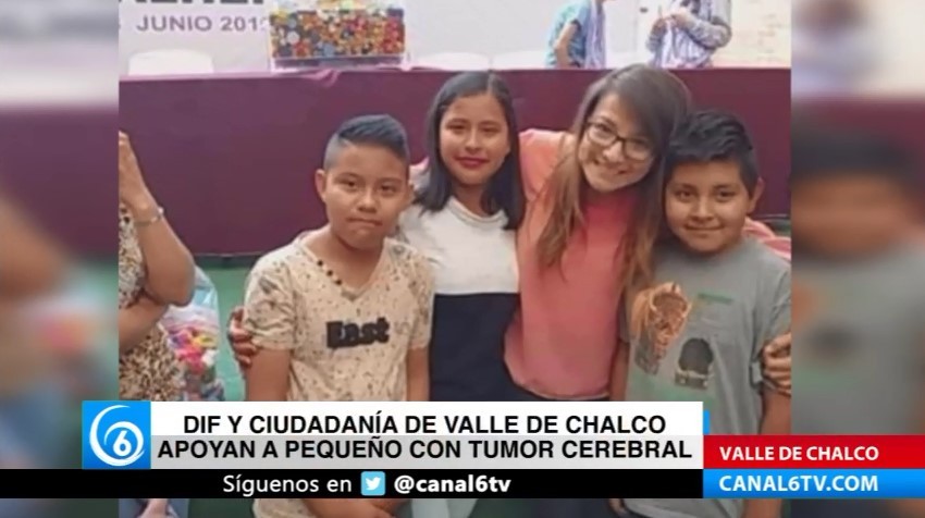 DIF y ciudadanía de Valle de Chalco apoyan a pequeño con tumor cerebral