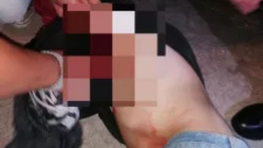 Joven sobrevive a ataque con arma blanca