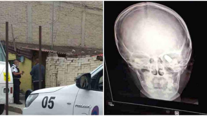Dan de alta a Dylan, pequeño lesionado por una bala perdida en Chimalhuacán