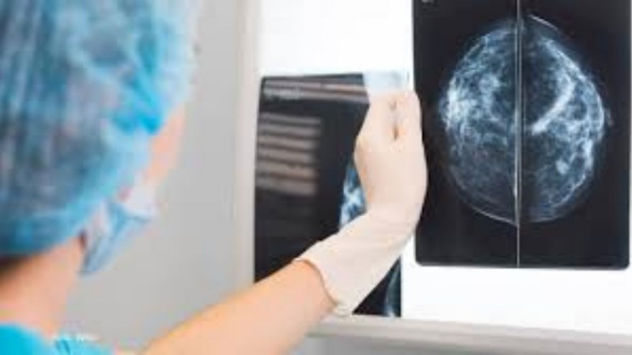 Cáncer de mama, la primera causa de muerte entre las mujeres de México