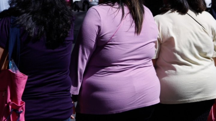 Obesidad, quinta causa de comorbilidad en infecciones por Covid-19
