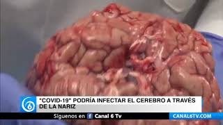 COVID-19 podría infectar el cerebro a través de la nariz