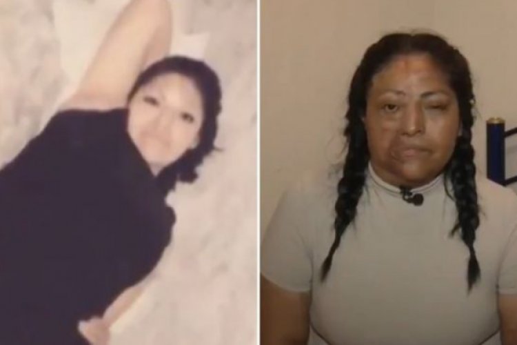 Buscan enjuiciar a sujeto acusado de aventar ácido a su exnovia