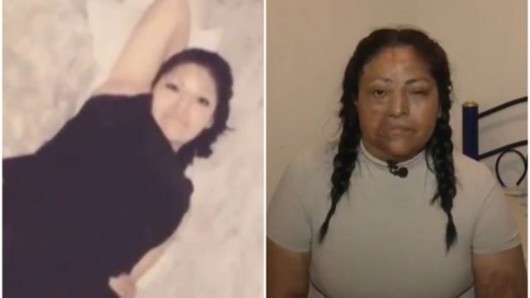 Buscan enjuiciar a sujeto acusado de aventar ácido a su exnovia