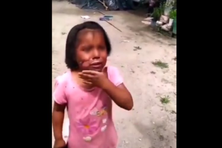Vídeo: Mujer quemaba a su nieta e hija con un cuchillo