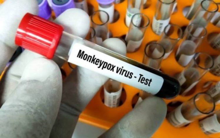 ¿Qué tan grave es la viruela del mono y cuales son los síntomas?