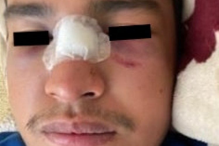 Golpean a repartidor de comida en Ecatepec