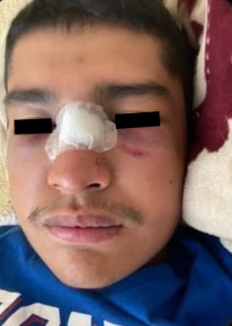 Golpean a repartidor de comida en Ecatepec