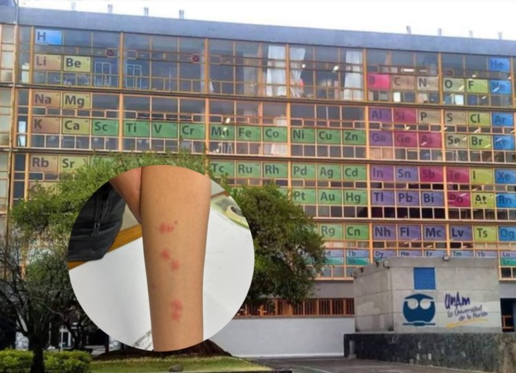 UNAM desmiente presencia de chinches en la Facultad de Química