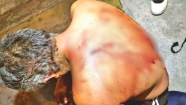 Acuchillan a hombre tras presunta pelea cerca del Metro Pantitlán