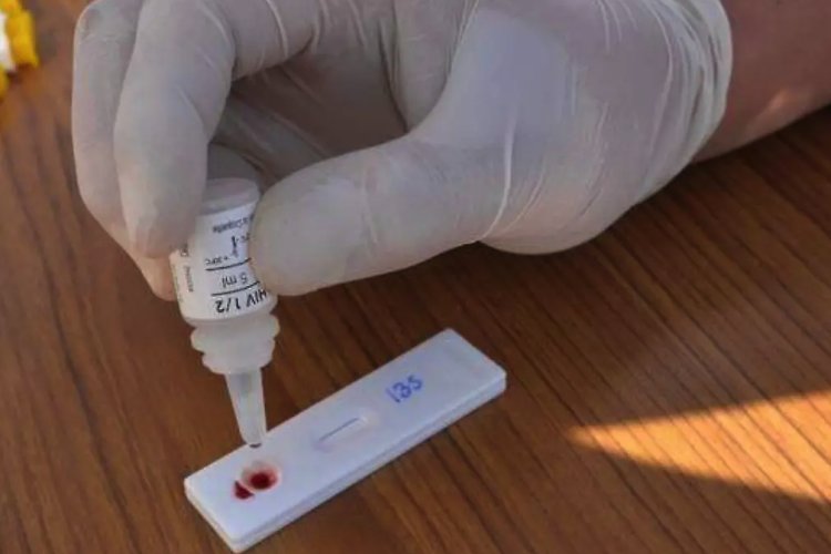 Estado de México entidad con más diagnósticos por casos de VIH