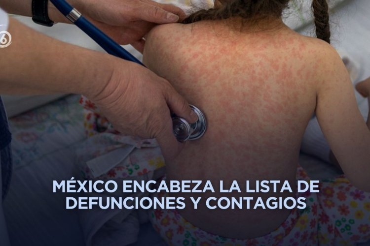 Emiten alerta epidemiológica por sarampión en todo el continente americano