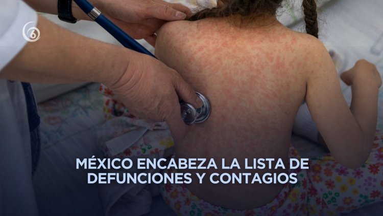Emiten alerta epidemiológica por sarampión en todo el continente americano