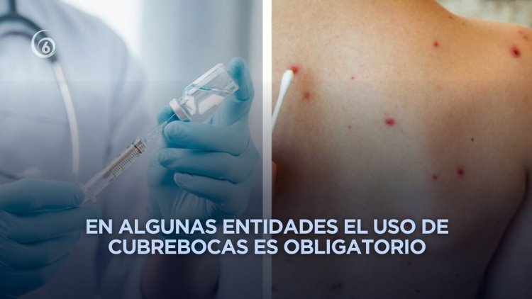 Refuerzan medidas en varios estados ante brote de sarampión en México